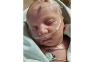 Bayi dengan Lubang di Jantung Tidak Mampu ‘Beli’ ASI