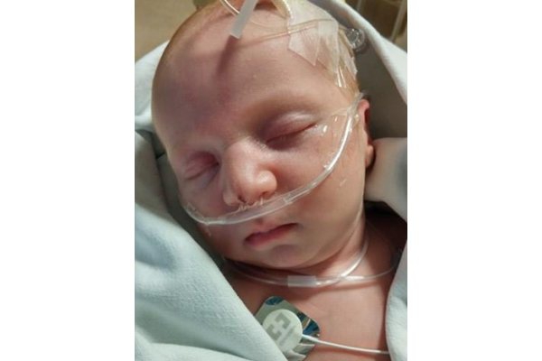 Bayi dengan Lubang di Jantung Tidak Mampu &#8216;Beli&#8217; ASI