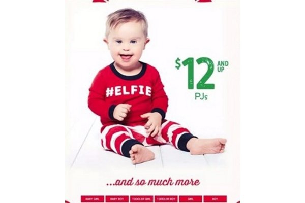 Balita Down Syndrome Jadi Model Iklan