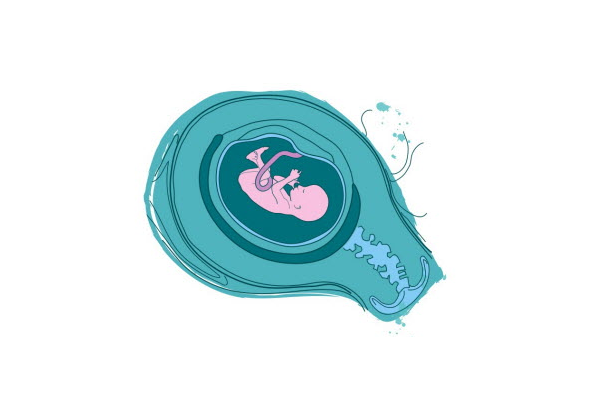 Fakta Di Balik Jahit Serviks saat Hamil