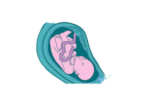 Bahaya &#8216;Kalung Usus&#8217; pada Janin