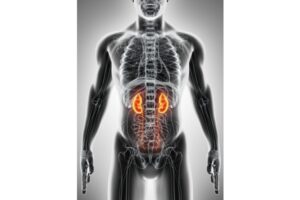 Waspadai Gejala Penyakit Gagal Ginjal Kronis