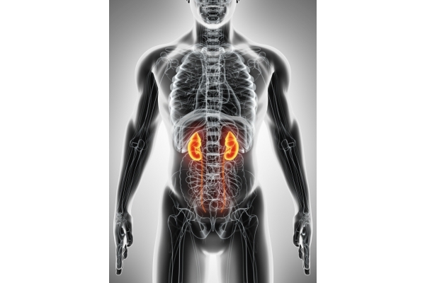 Waspadai Gejala Penyakit Gagal Ginjal Kronis