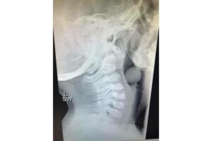 Waspada! Buah Anggur Berisiko Bikin Anak Tersedak