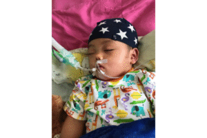 Kisah Bayi Gibran yang Koma karena Encephalitis