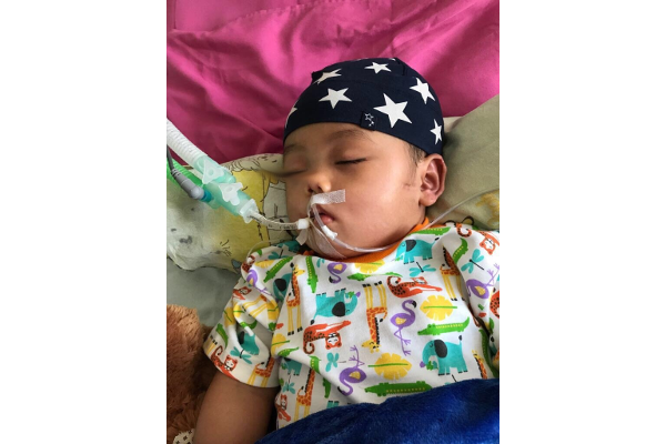 Kisah Bayi Gibran yang Koma karena Encephalitis
