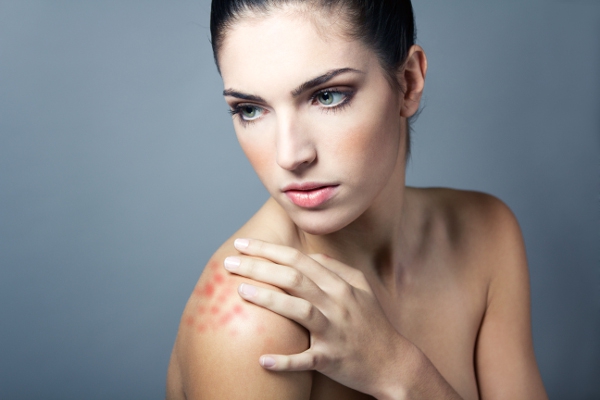 Bercak Merah Bersisik itu adalah Psoriasis