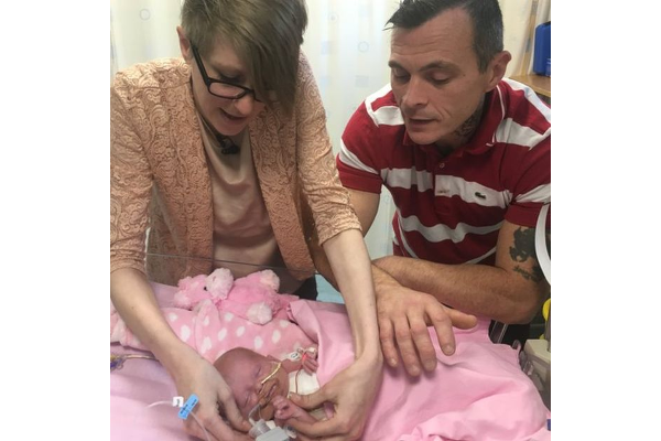 Bayi Lahir dengan Kondisi Jantung Berada di Luar Tubuh