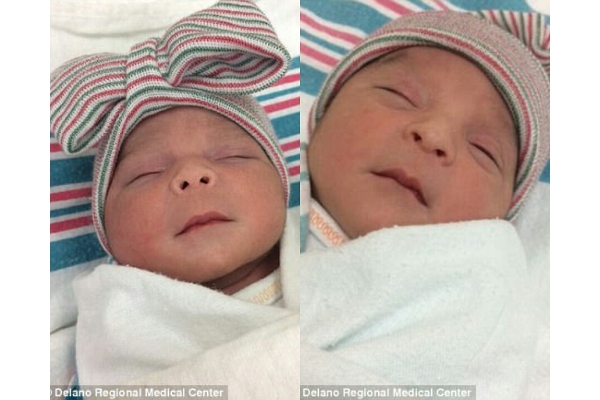 Wow, Bayi Kembar Ini Lahir di Tahun yang Berbeda!