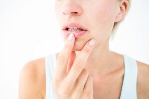 Penjelasan BPOM Soal Keamanan Obat Sariawan Albothyl