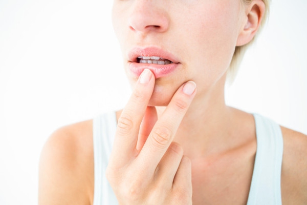 Penjelasan BPOM Soal Keamanan Obat Sariawan Albothyl