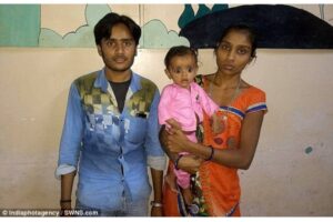 Bayi 7 Bulan Ini &#8216;Hamil&#8217; Kembarannya Sendiri