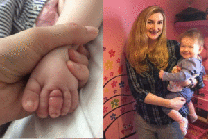 Jari Kaki Bayi Ini Hampir Putus Karena Sehelai Rambut