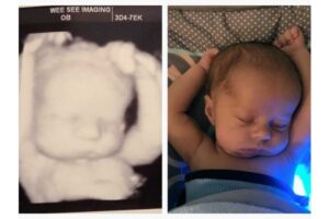 Bayi Gemas Ini Punya Kisah Pilu Dibalik Posisi Tidurnya