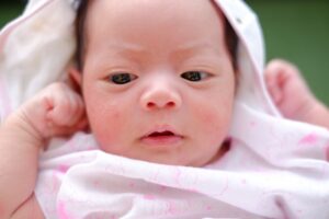 Kenali Tanda Biang Keringat pada Si Kecil