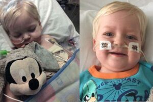 Langka! Paru-paru Anak 2 Tahun Ini Dipenuhi Kista