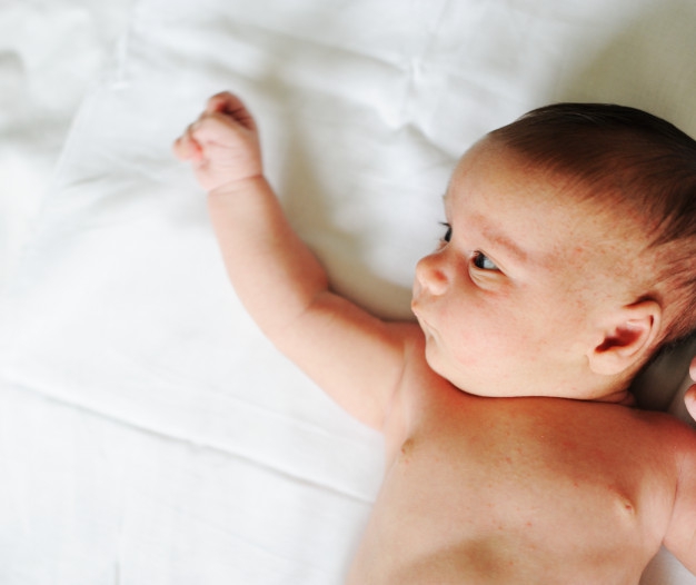 Kenali Urtikaria, Penyakit Biduran Pada Anak