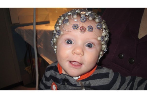 Diagnosis Autisme Sejak Dini dengan EEG Sederhana