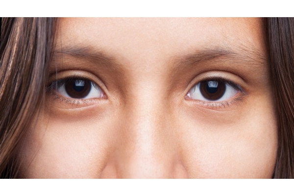 Kenali Penyebab Kebutaan, Retinopati Diabetika