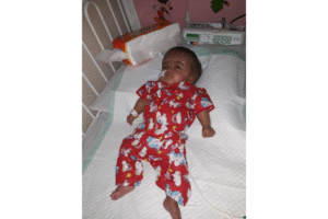 Perjuangan Lalita Melawan Hidrosefalus