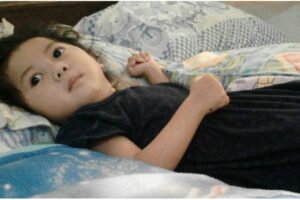 Kenali Sindrom Ohtahara, Epilepsi Langka pada Anak