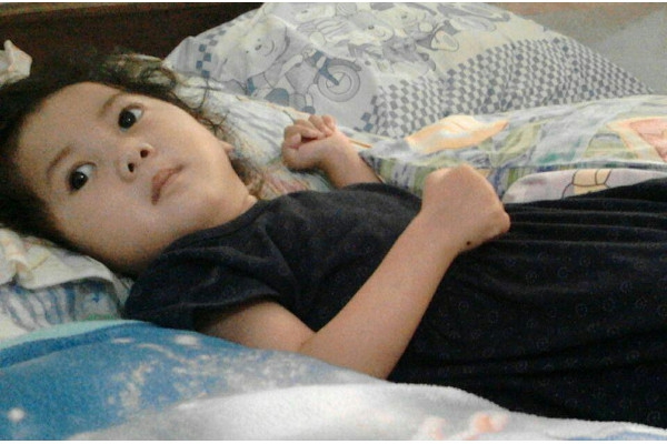 Kenali Sindrom Ohtahara, Epilepsi Langka pada Anak