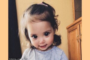 Bermata Indah, Bayi Ini Ternyata Idap Penyakit Langka