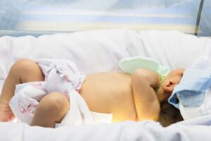 Apa Penyebab Bayi Mengalami Penyakit Kuning?