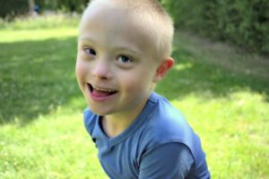 10 Fakta Down Syndrome pada Balita