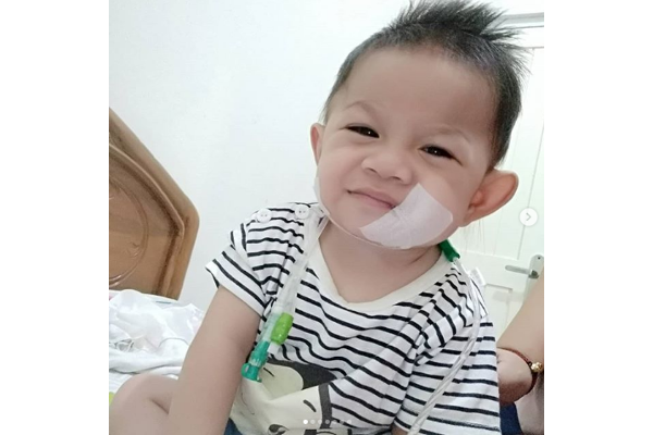 Perjuangan Baby Kenzie yang Terlahir Tanpa Anus