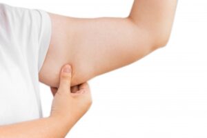 Tips Ampuh Atasi Lengan Besar Bergelambir