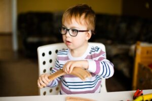 Fakta Sindrom Williams yang Diderita Anak Dede Sunandar