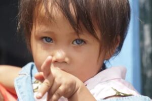 Kisah Unik Balita dengan Warna Bola Mata bisa Berubah