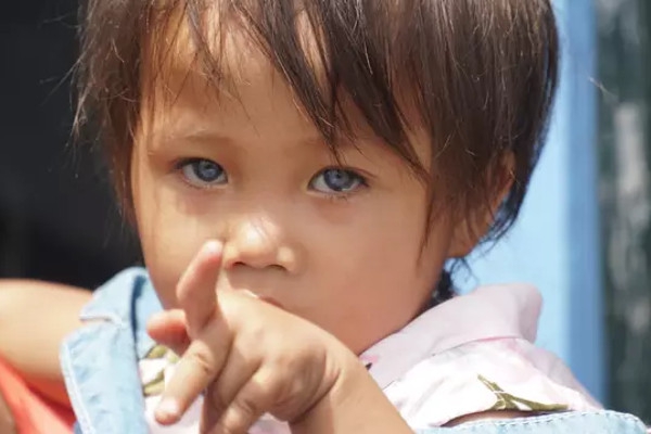 Kisah Unik Balita dengan Warna Bola Mata bisa Berubah