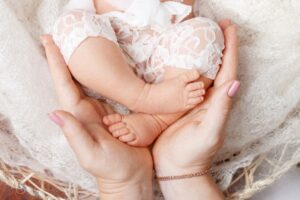 Waspada Clubfoot atau Kaki Pengkor pada Bayi!