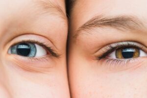 Anak Buta Warna, Ini yang bisa Orang Tua Lakukan