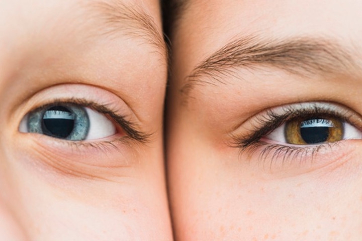 Anak Buta Warna, Ini yang bisa Orang Tua Lakukan