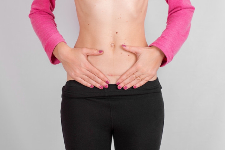 Moms, Ketahui Langkah Merawat Luka Persalinan Caesar