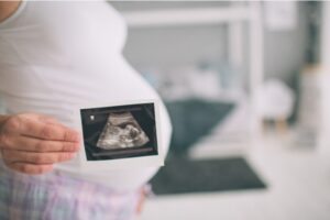 Dampak Virus Corona bagi Kehamilan dan Janin