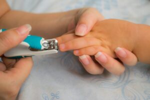 Cara Mengatasi Masalah Kuku Cantengan pada Anak