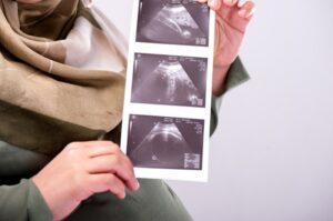 Cara Membayar Fidyah untuk Ibu Hamil dan Menyusui