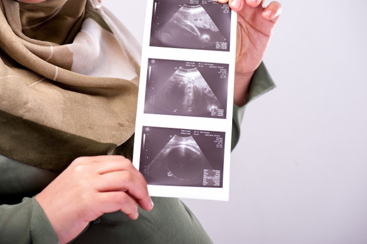 Cara Membayar Fidyah untuk Ibu Hamil dan Menyusui