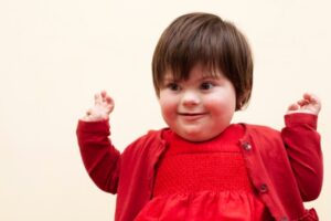 Kenali Sindrom Williams yang Dialami Anak Dede Sunandar