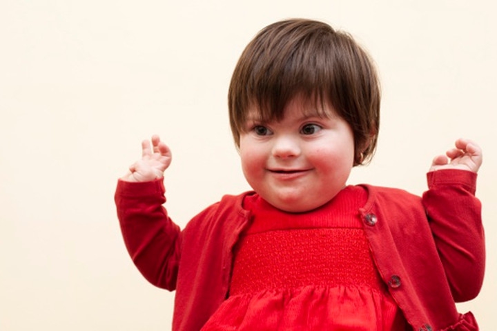 Kenali Sindrom Williams yang Dialami Anak Dede Sunandar