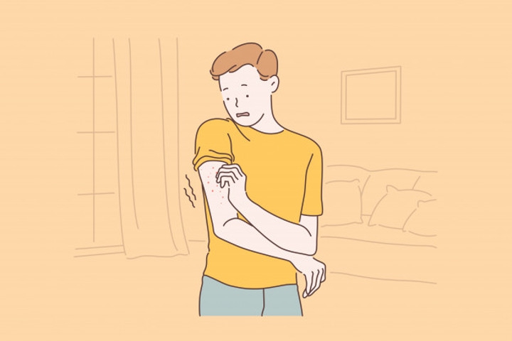 Benarkah Stres Bisa Timbulkan Gatal? Ini Penjelasannya