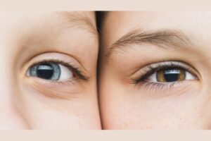 Kenali 7 Jenis Buta Warna yang Bisa Terjadi pada Anak