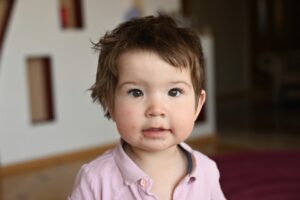 Waspada, Herpes Bisa Berakibat Fatal pada Bayi