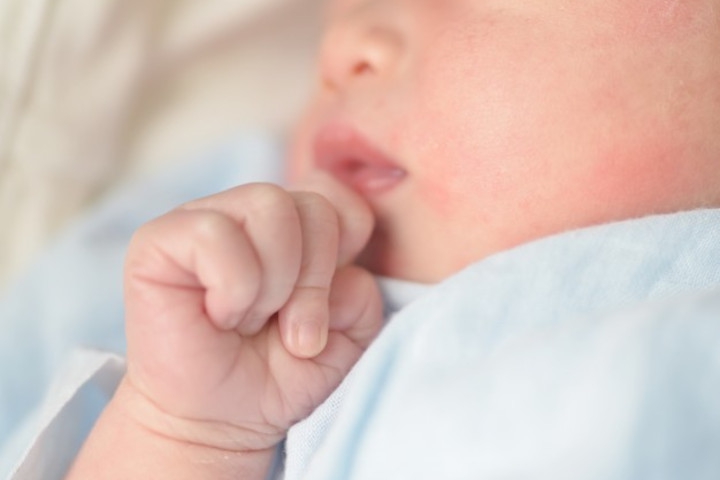 Kulit Bayi Bruntusan, Ini Penyebab dan Cara Mengatasinya