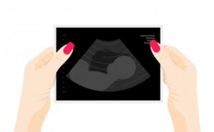 7 Hal yang Perlu Dilakukan Usai Mengalami Keguguran