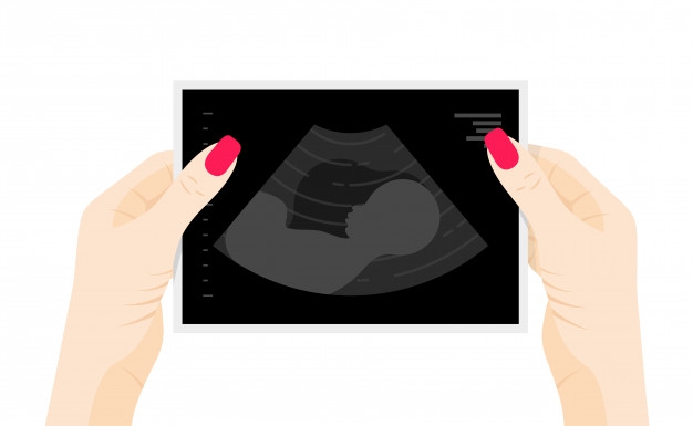 7 Hal yang Perlu Dilakukan Usai Mengalami Keguguran